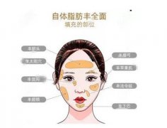 填充納米脂肪有什么效果