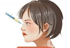 達(dá)拉斯鼻部整形手術(shù)的效果能持續(xù)多久？