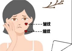 哪些因素影響電波拉皮的價格