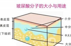 伊維蘭注射豐胸的優(yōu)點(diǎn)和特點(diǎn)