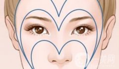 提眉手術(shù)有何特點(diǎn)，有哪些適應(yīng)癥