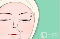 全切與埋線雙眼皮手術(shù)有何優(yōu)缺點(diǎn)？