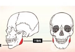 顴骨整形手術(shù)有副作用嗎？