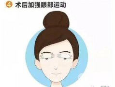 雙眼皮手術(shù)的優(yōu)點和風險有哪些