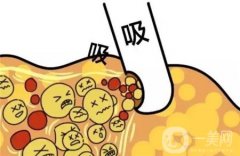 水動力吸脂怎么樣，會導(dǎo)致皮膚松弛嗎