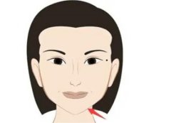 下巴塑形后需注意的禁忌事項