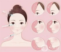 自體脂肪豐胸的潛在風(fēng)險