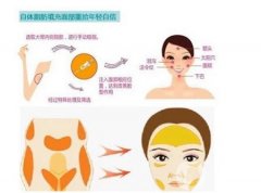 自體脂肪豐胸需要做多少次手術(shù)？