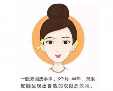 眼瞼外翻的手術(shù)方法有哪些