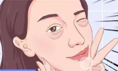 針對(duì)不同類型的腫泡眼的方法