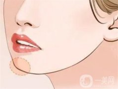墊下巴手術(shù)的費(fèi)用是多少