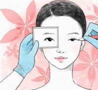割雙眼皮后會(huì)留有后遺癥狀呢？