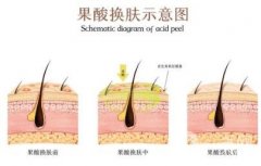 彩光嫩膚后化妝有哪些注意事項