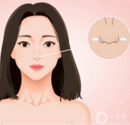 鼻孔縮小手術(shù)是否安全？是否有風(fēng)險