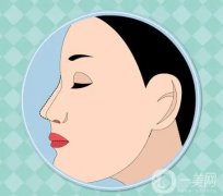 鼻綜合感染的應對與預防措施