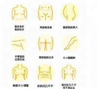 水動(dòng)力吸脂術(shù)后需要多久才能恢復(fù)