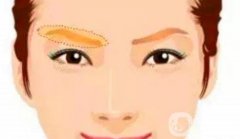 提眉手術(shù)的風(fēng)險(xiǎn)有哪些