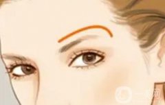 提眉術(shù)與切眉術(shù)存在哪些差異？