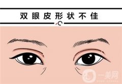 臥蠶可以通過手術(shù)實(shí)現(xiàn)嗎