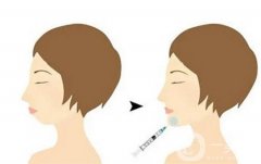 下巴注射玻尿酸后為什么會(huì)出現(xiàn)硬塊呢？