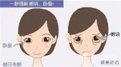 眼袋修復(fù)的方法有哪些？