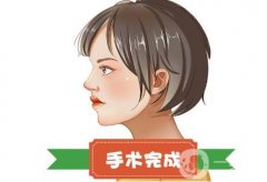 有哪些矯正鼻骨的方法呢？