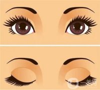 眼窩填充是否需要手術(shù)呢？