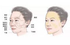 自體脂肪填充手術(shù)可能有哪些風(fēng)險(xiǎn)？