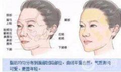 自體脂肪豐臉的特點(diǎn)