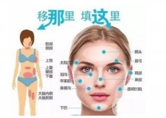 自體脂肪填充額頭有什么缺點(diǎn)？