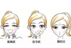 做線雕蛋白線如何呢？