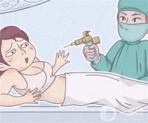 哪些人群應避免注射溶脂針呢？