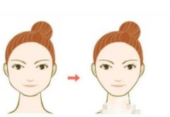 切骨手術(shù)怎么樣，有潛在風(fēng)險(xiǎn)嗎