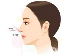 膨體隆鼻后取出是否真的困難？