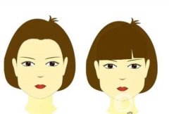顴骨墊高手術的效果如何，恢復時間長嗎