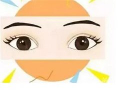 上瞼下垂的遺傳性診斷標(biāo)準(zhǔn)有哪些呢？