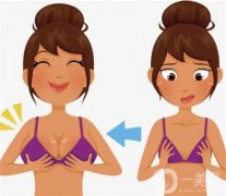 乳暈縮小手術(shù)的效果如何呢？