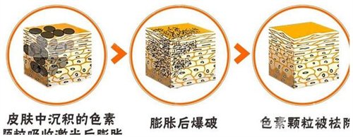 天津醫(yī)科大學(xué)腫瘤醫(yī)院整形科價(jià)格表，附激光祛斑恢復(fù)果圖